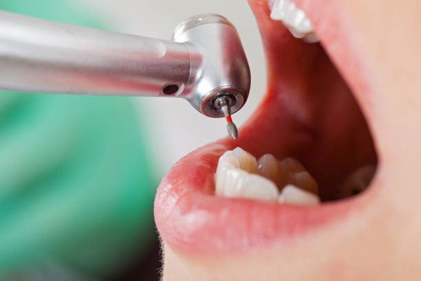 Best Emergency TMJ Treatment in Belgrade, MT